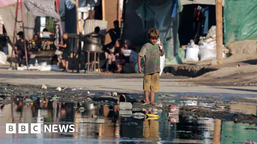 Diseases spread in Gaza as sewage contaminates camps and coast