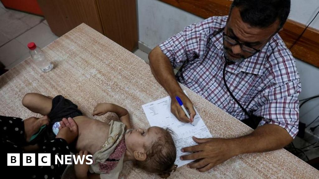 Baby contracts Gaza's first case of polio in 25 years