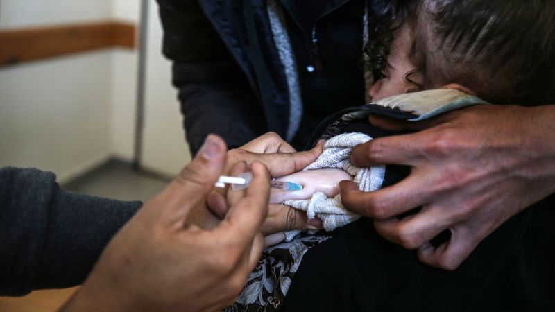 10-month-old contracts Gaza’s first case of polio in 25 years