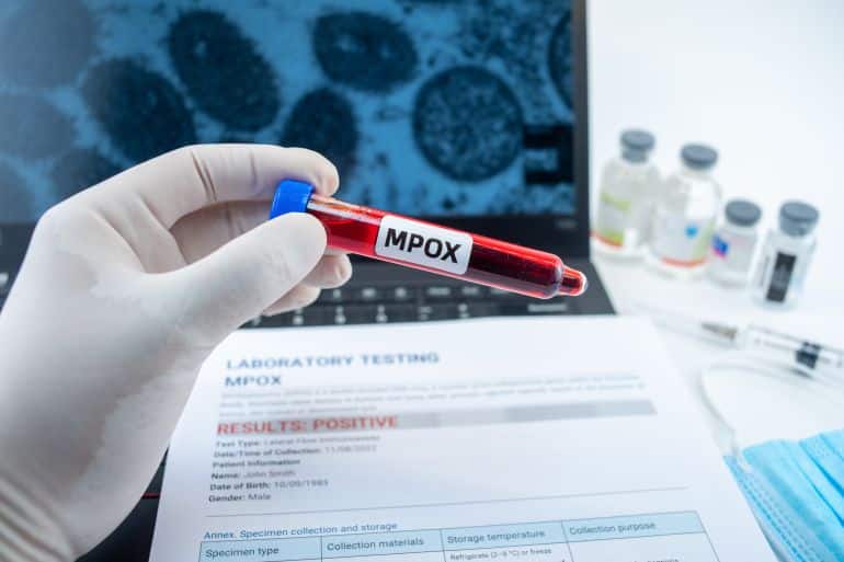 Blood collection tubes Mpox test positive results, WHO to rename monkeypox as ‘Mpox’