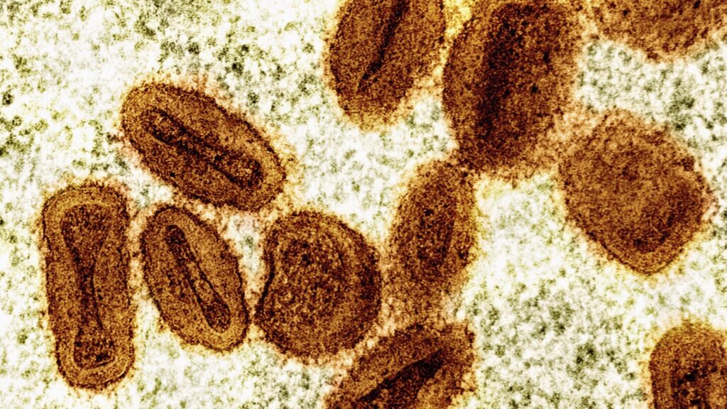 US health officials report 1st case of new form of mpox in a traveler