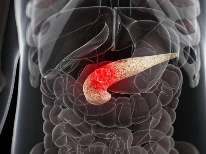 طريقة سريعة لاكتشاف سرطان البنكرياس قبل فوات الأوان - إيماجو
